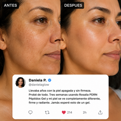 Rosalia Gel Facial Anti-Edad