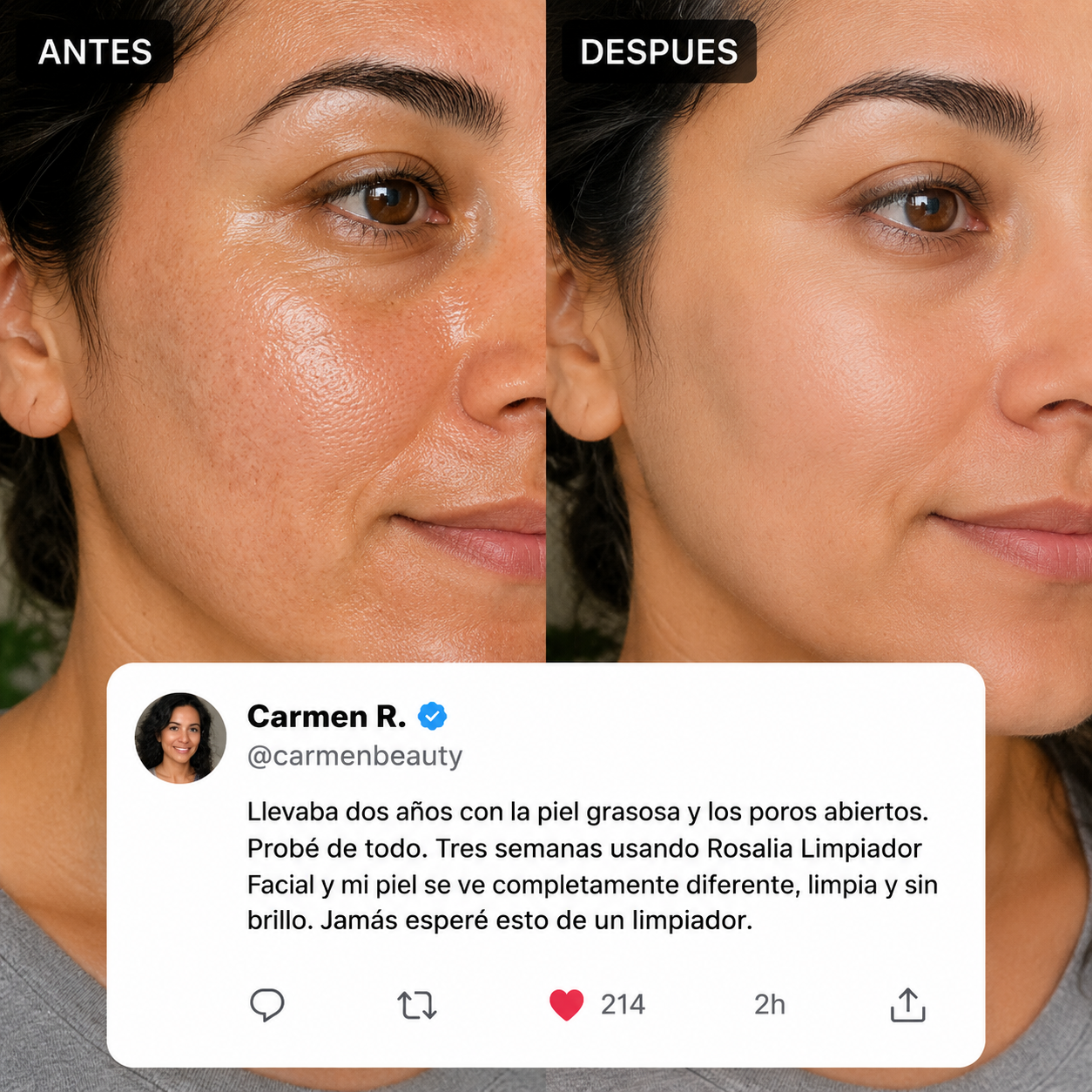 Rosalia Limpiador Facial Anti-Grasa